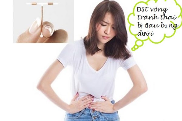 Đặt vòng tránh thai bị đau bụng dưới có nguy hiểm không?
